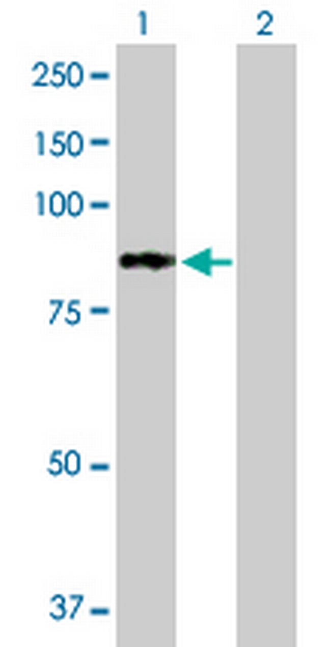 PFKL Antibody in Western Blot (WB)