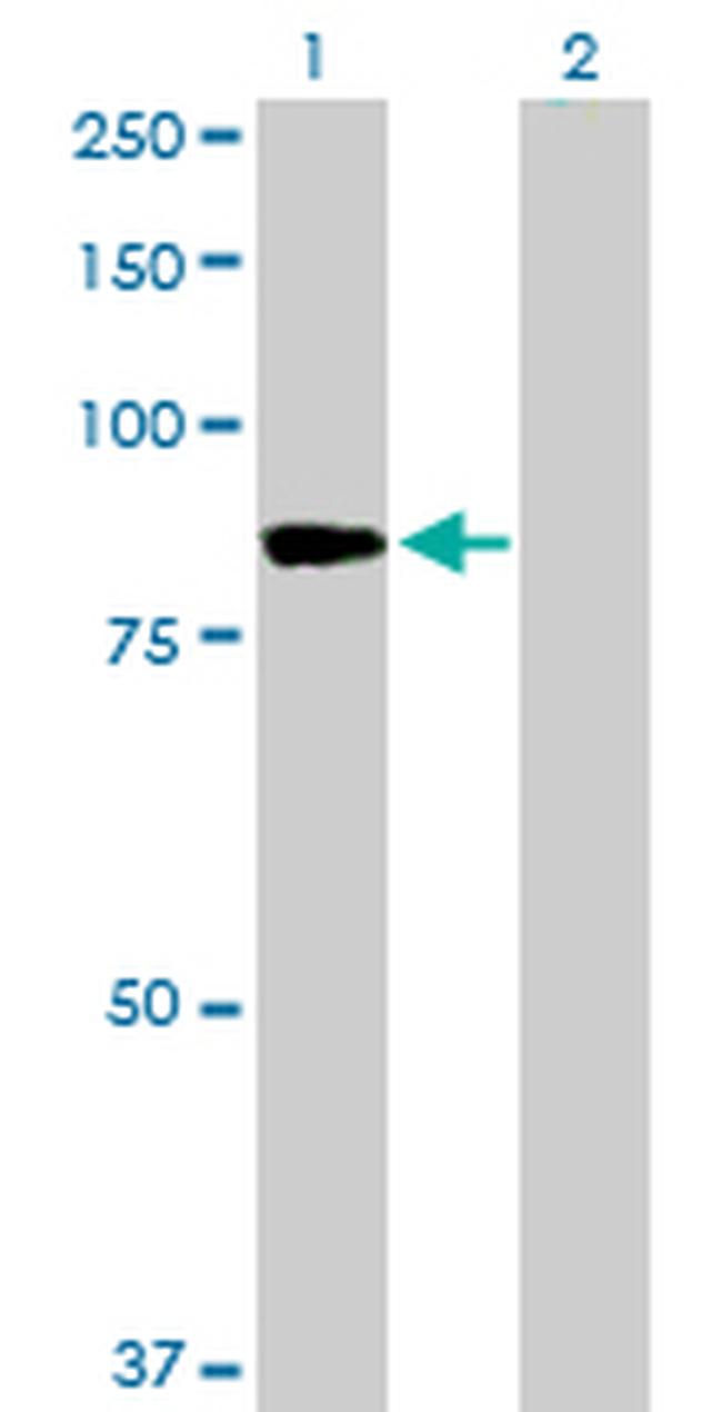 PFKM Antibody in Western Blot (WB)