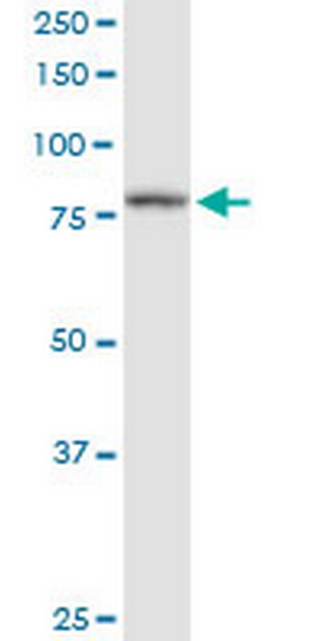 PFKP Antibody in Western Blot (WB)