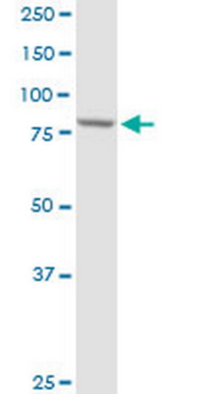 PFKP Antibody in Western Blot (WB)