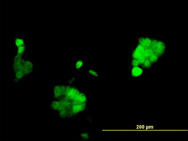 PGR Antibody in Immunocytochemistry (ICC/IF)