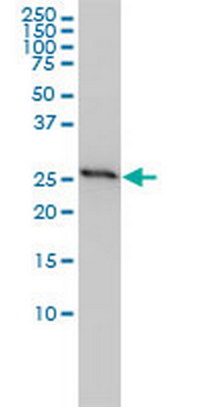 PHB Antibody in Western Blot (WB)