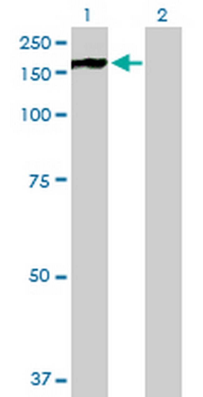 PHKA2 Antibody in Western Blot (WB)