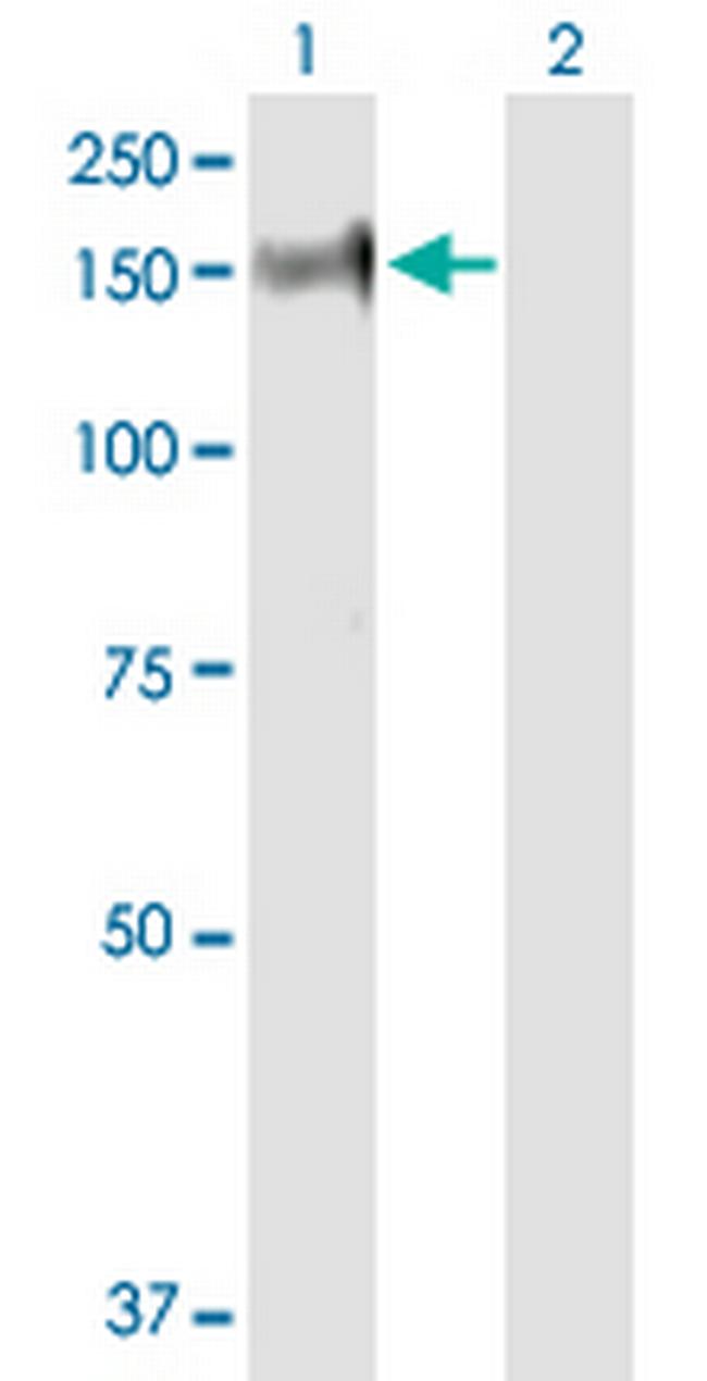 PHKA2 Antibody in Western Blot (WB)