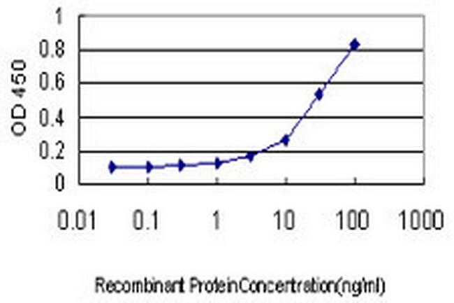 PHKG1 Antibody in ELISA (ELISA)