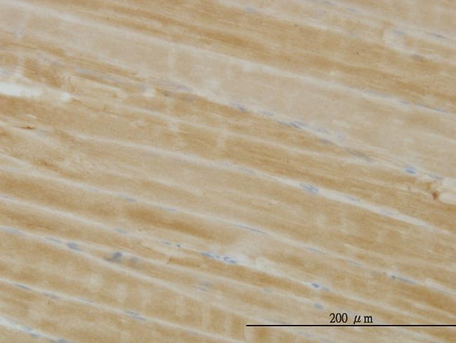 PHKG1 Antibody in Immunohistochemistry (Paraffin) (IHC (P))