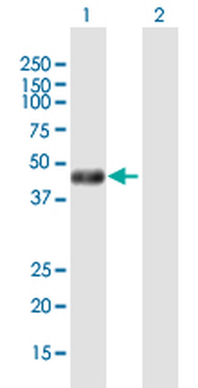 PHKG2 Antibody in Western Blot (WB)