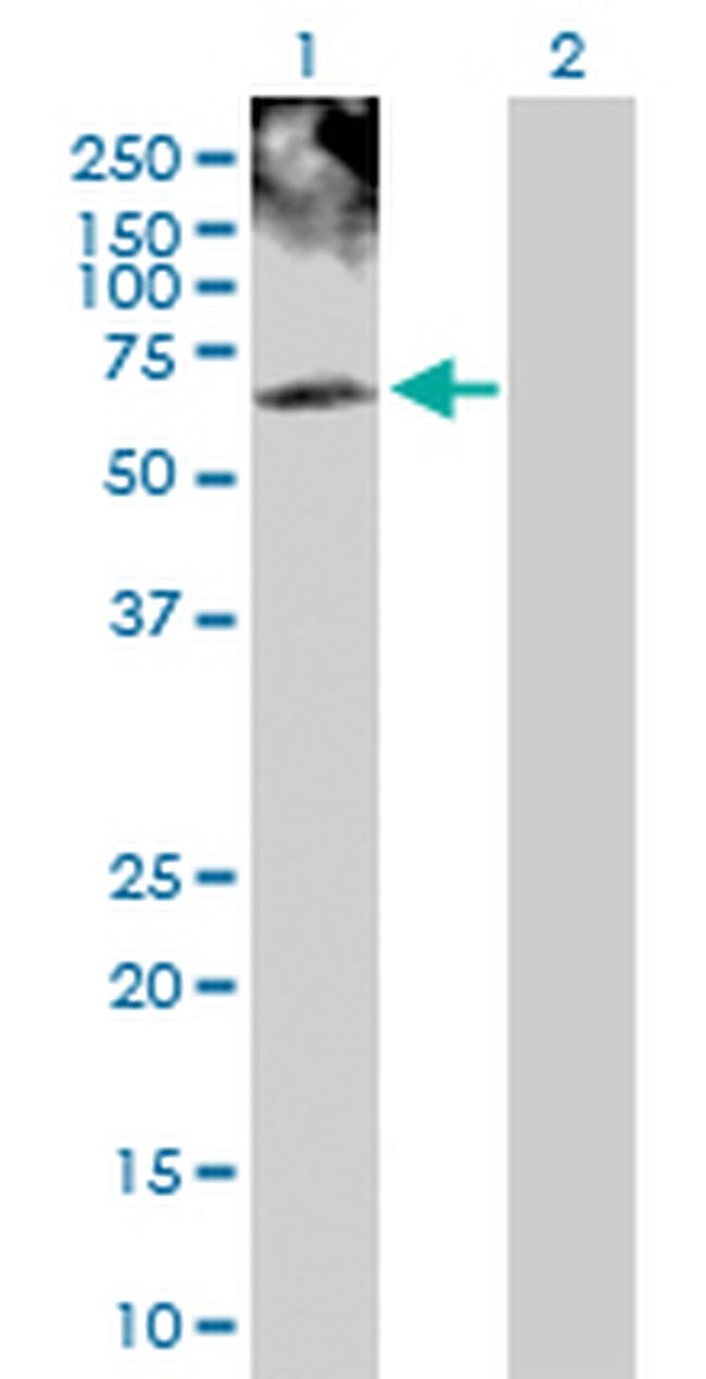 PHKG2 Antibody in Western Blot (WB)