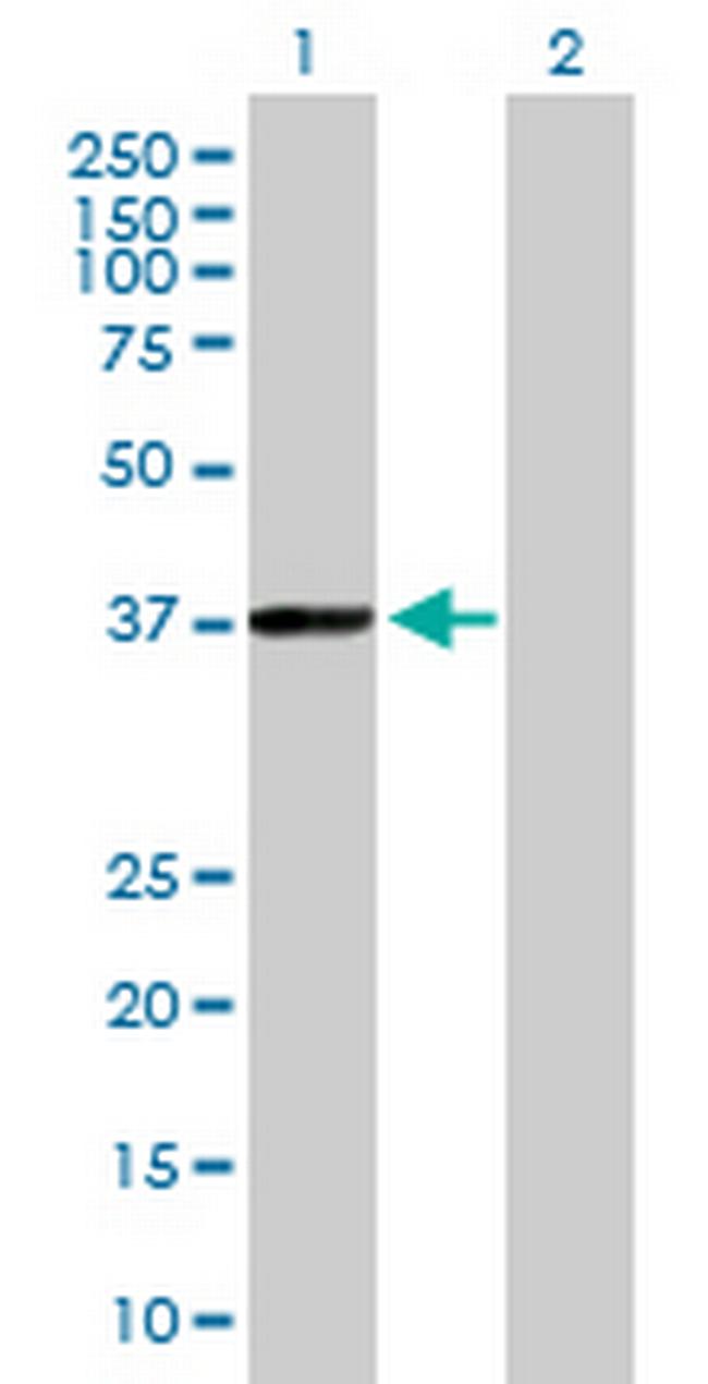 PHYH Antibody in Western Blot (WB)