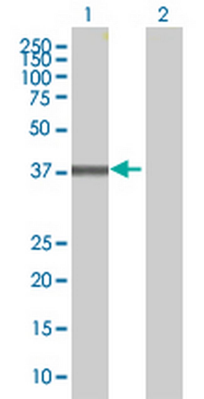 SERPINB9 Antibody in Western Blot (WB)