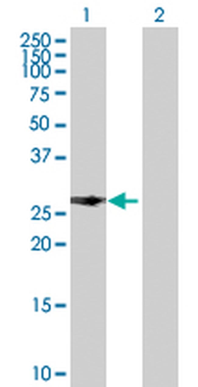 PITX2 Antibody in Western Blot (WB)