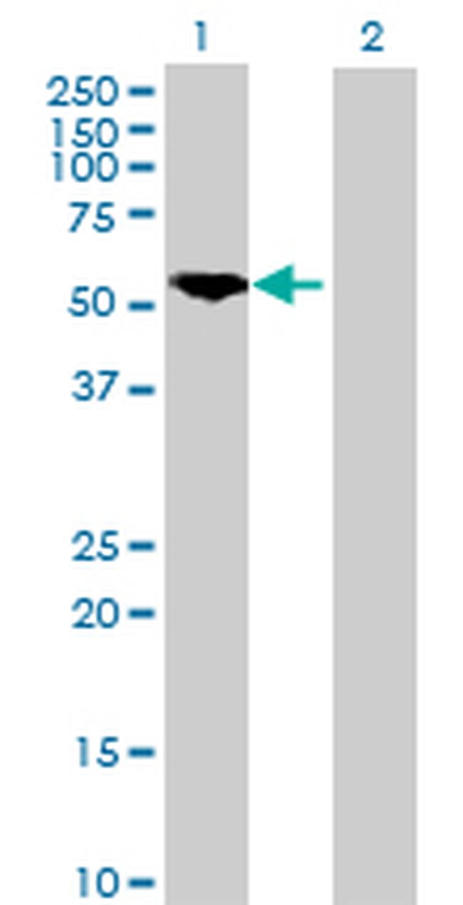 PKM2 Antibody in Western Blot (WB)