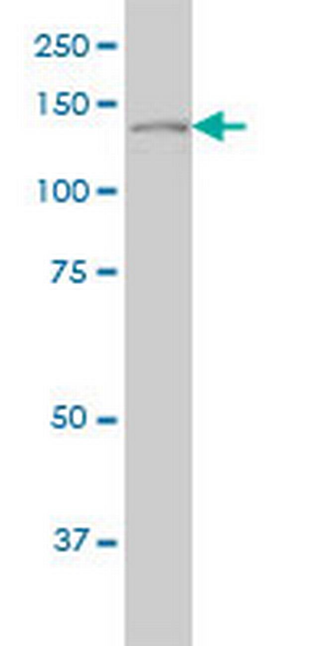 PLCG1 Antibody in Western Blot (WB)