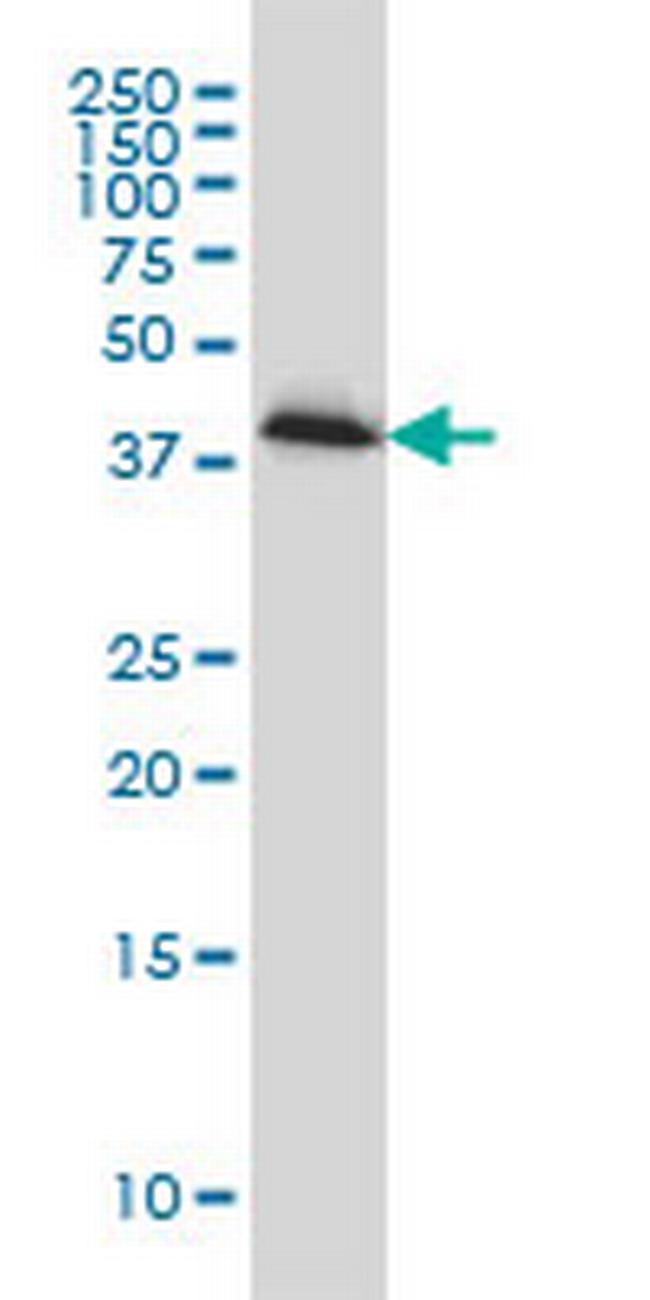 PLEK Antibody in Western Blot (WB)