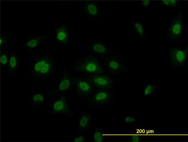 PLK1 Antibody in Immunocytochemistry (ICC/IF)