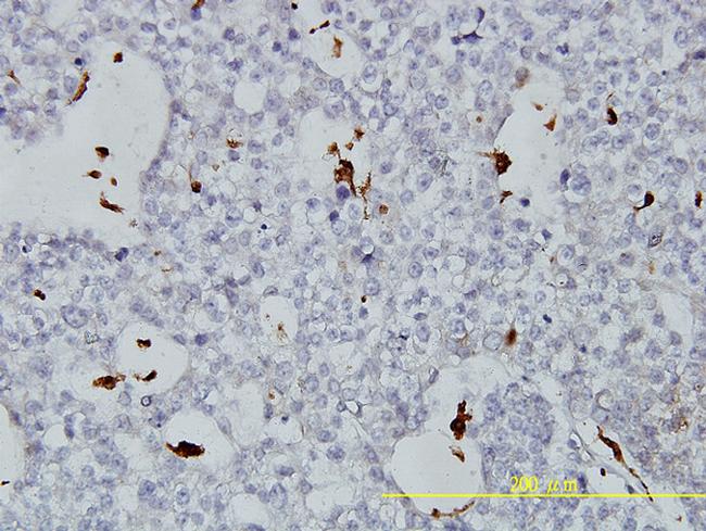 PLTP Antibody in Immunohistochemistry (Paraffin) (IHC (P))