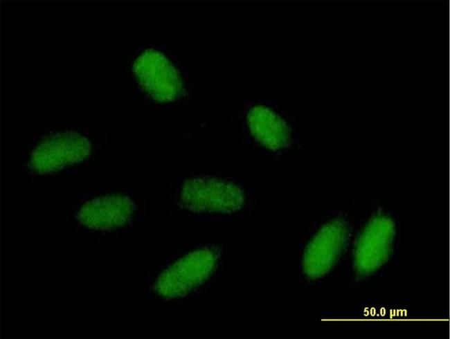 PRRX1 Antibody in Immunocytochemistry (ICC/IF)