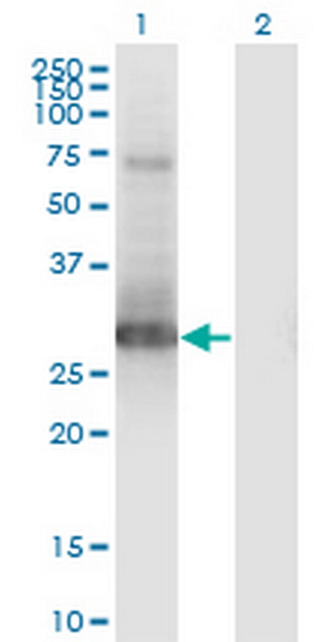 PRRX1 Antibody in Western Blot (WB)