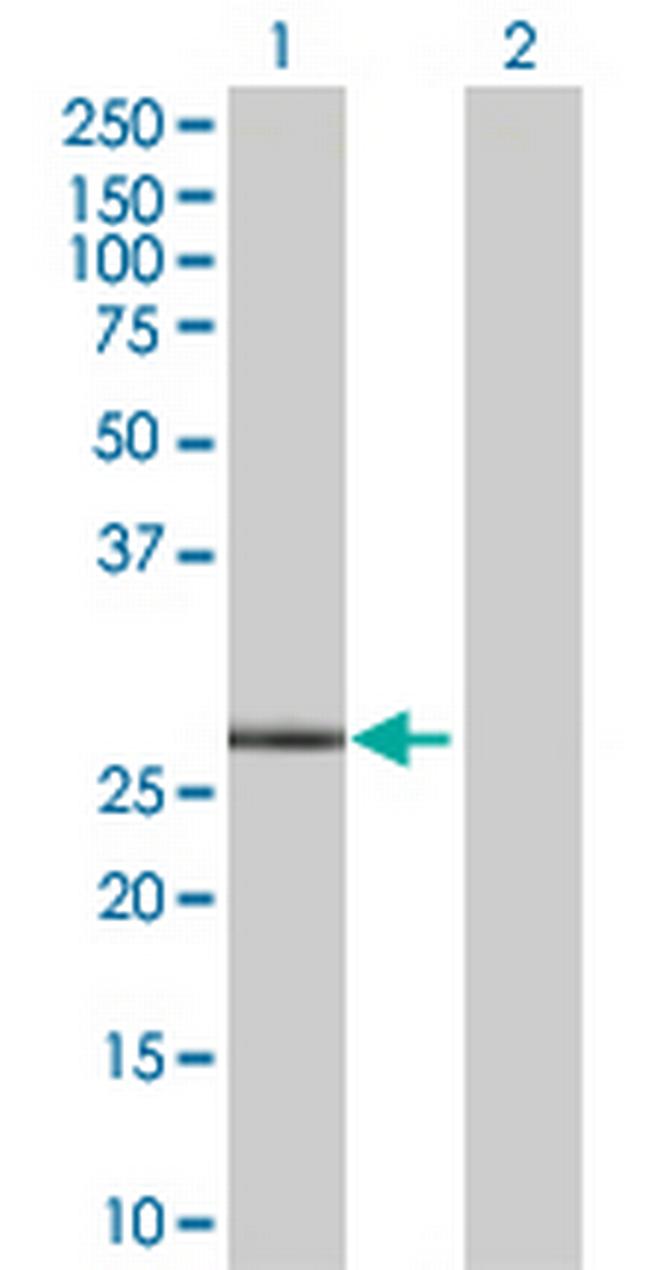 PNMT Antibody in Western Blot (WB)