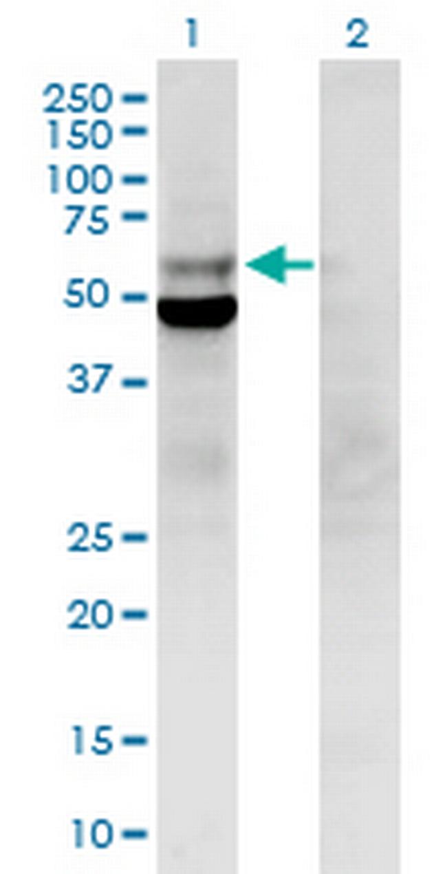 POLD2 Antibody in Western Blot (WB)