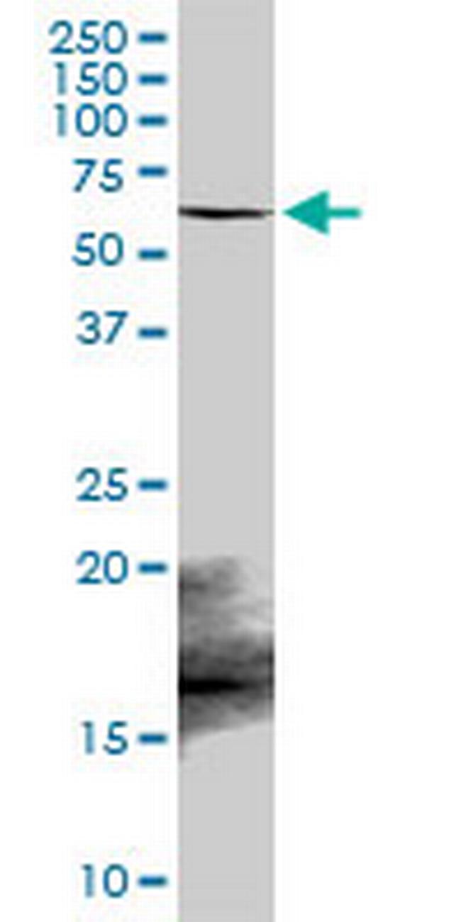 PPARA Antibody in Western Blot (WB)