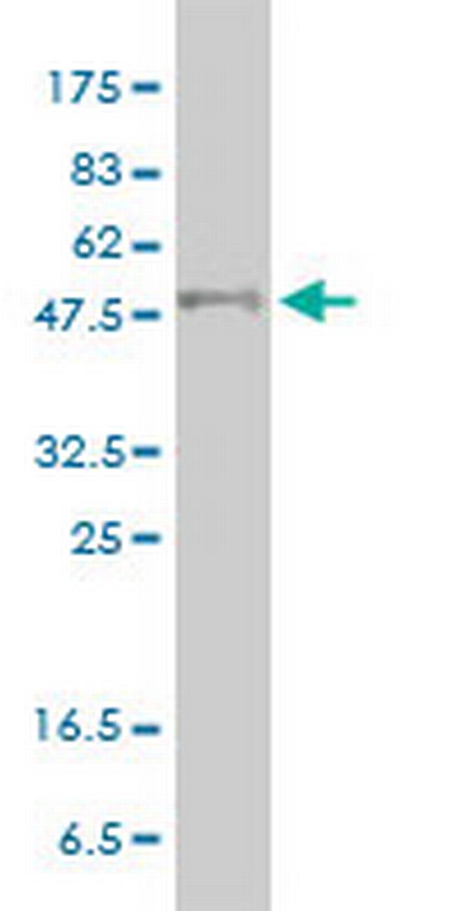 PPARD Antibody in Western Blot (WB)