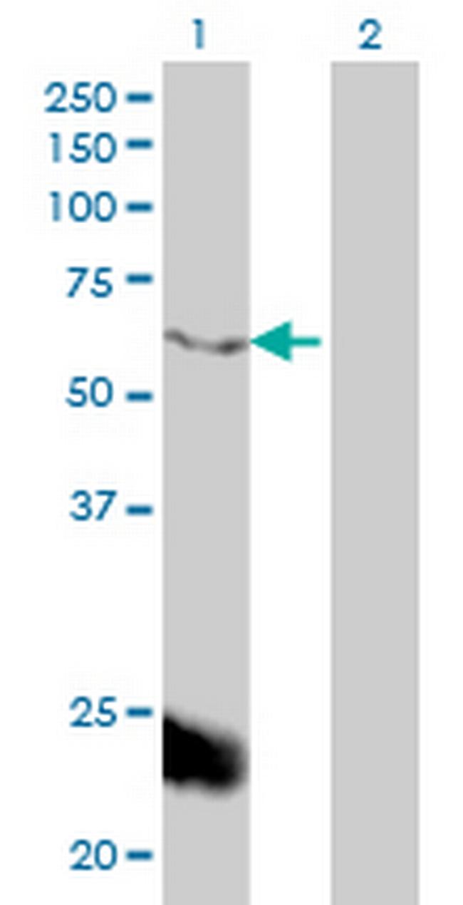 PPARBP Antibody in Western Blot (WB)