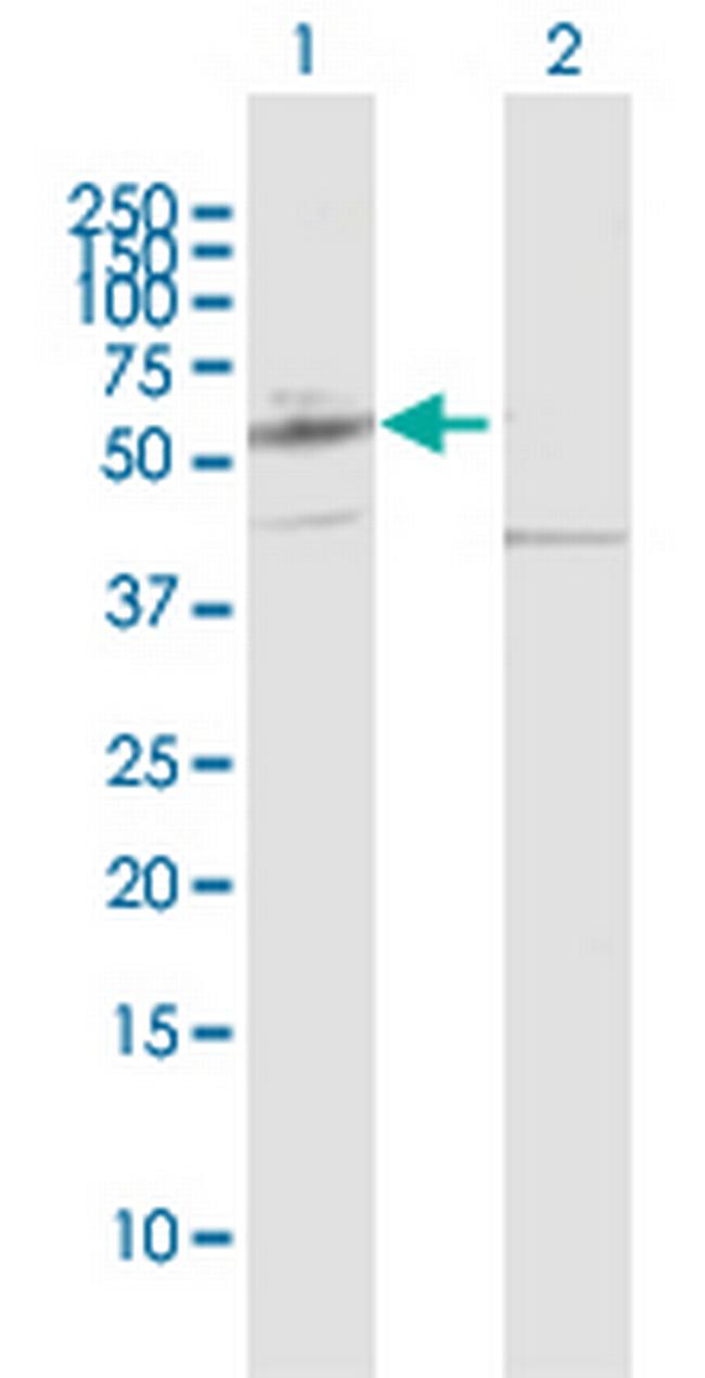 PPAT Antibody in Western Blot (WB)