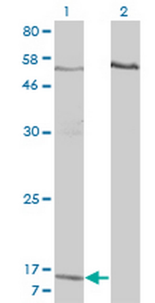 PPBP Antibody in Western Blot (WB)