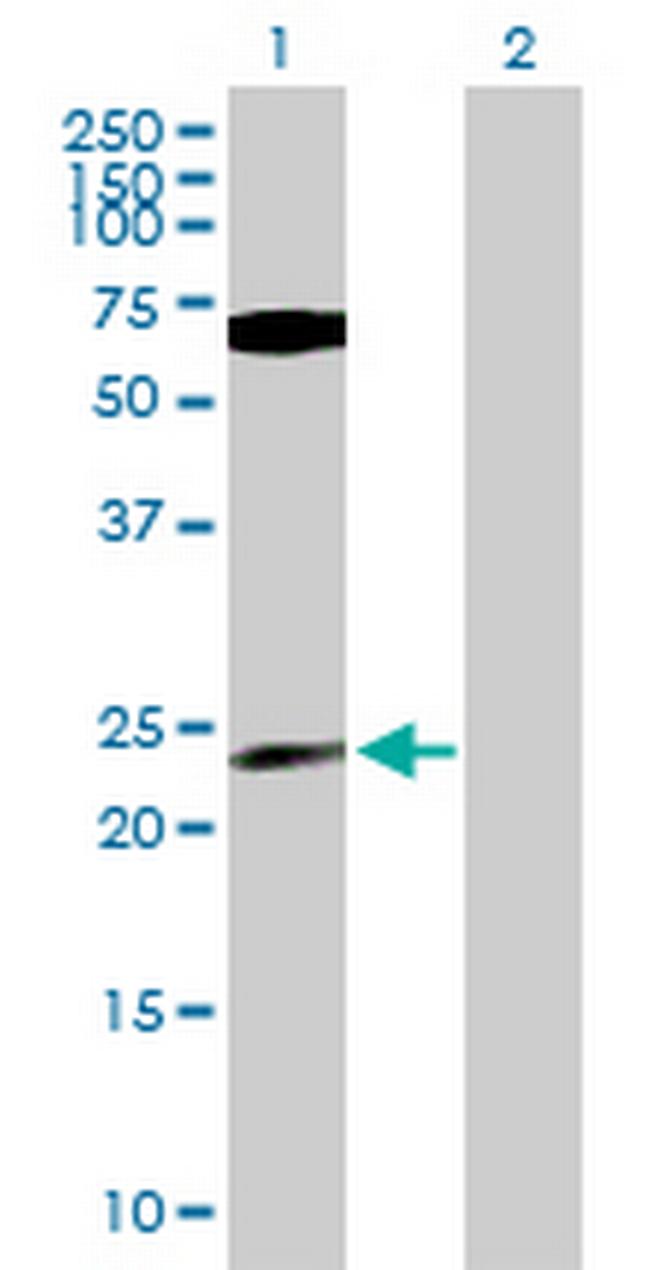 PPP1CB Antibody in Western Blot (WB)