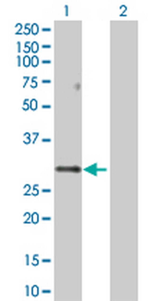 PPP1R2 Antibody in Western Blot (WB)