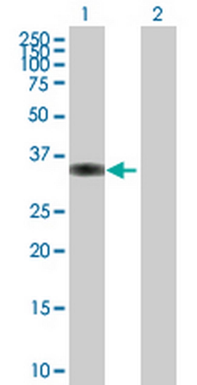 PPP1R3C Antibody in Western Blot (WB)