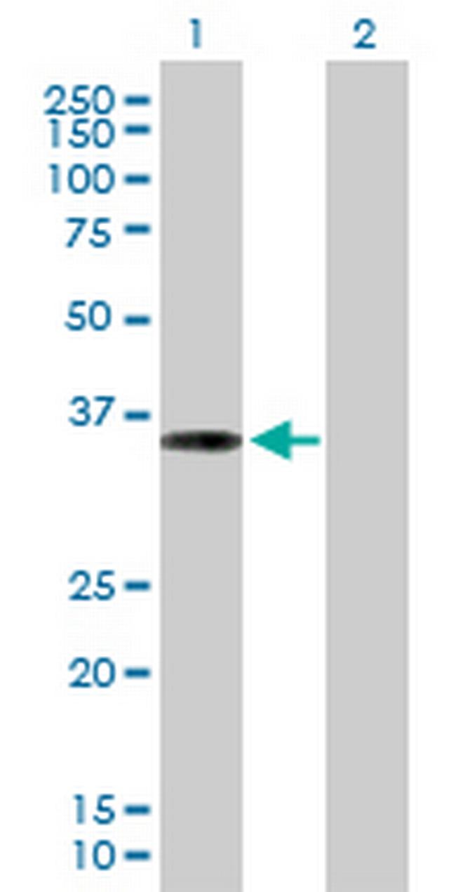 PPP1R3C Antibody in Western Blot (WB)