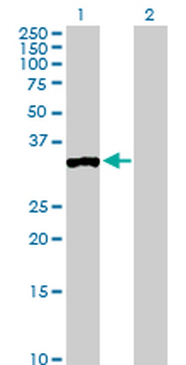 PPP1R3C Antibody in Western Blot (WB)