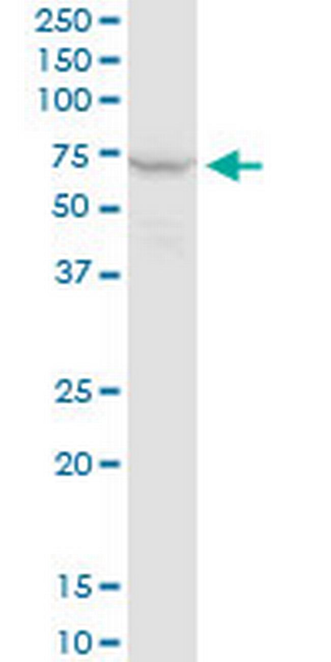 PPP2R1A Antibody in Western Blot (WB)