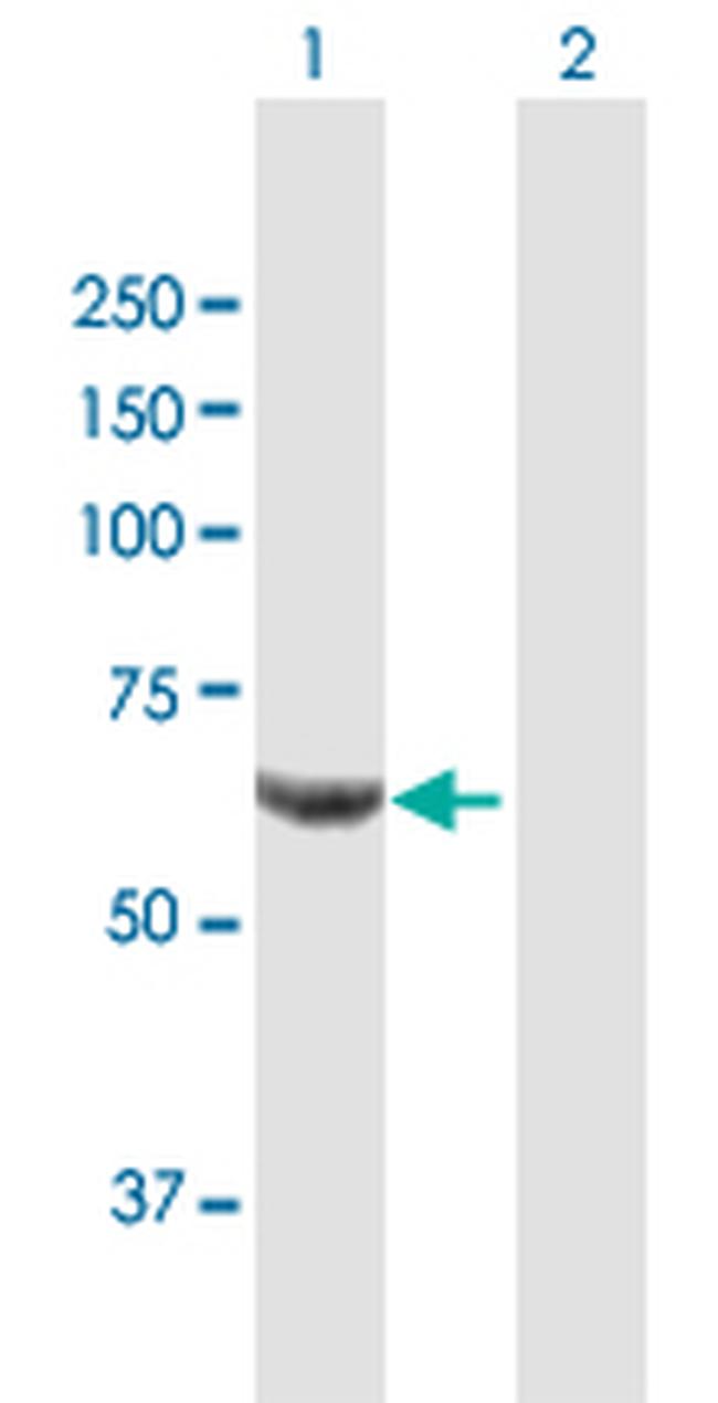 PPP2R1B Antibody in Western Blot (WB)