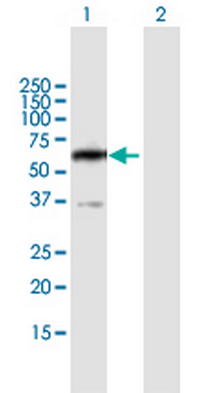 PPP2R5B Antibody in Western Blot (WB)