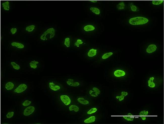 PPP3CA Antibody in Immunocytochemistry (ICC/IF)