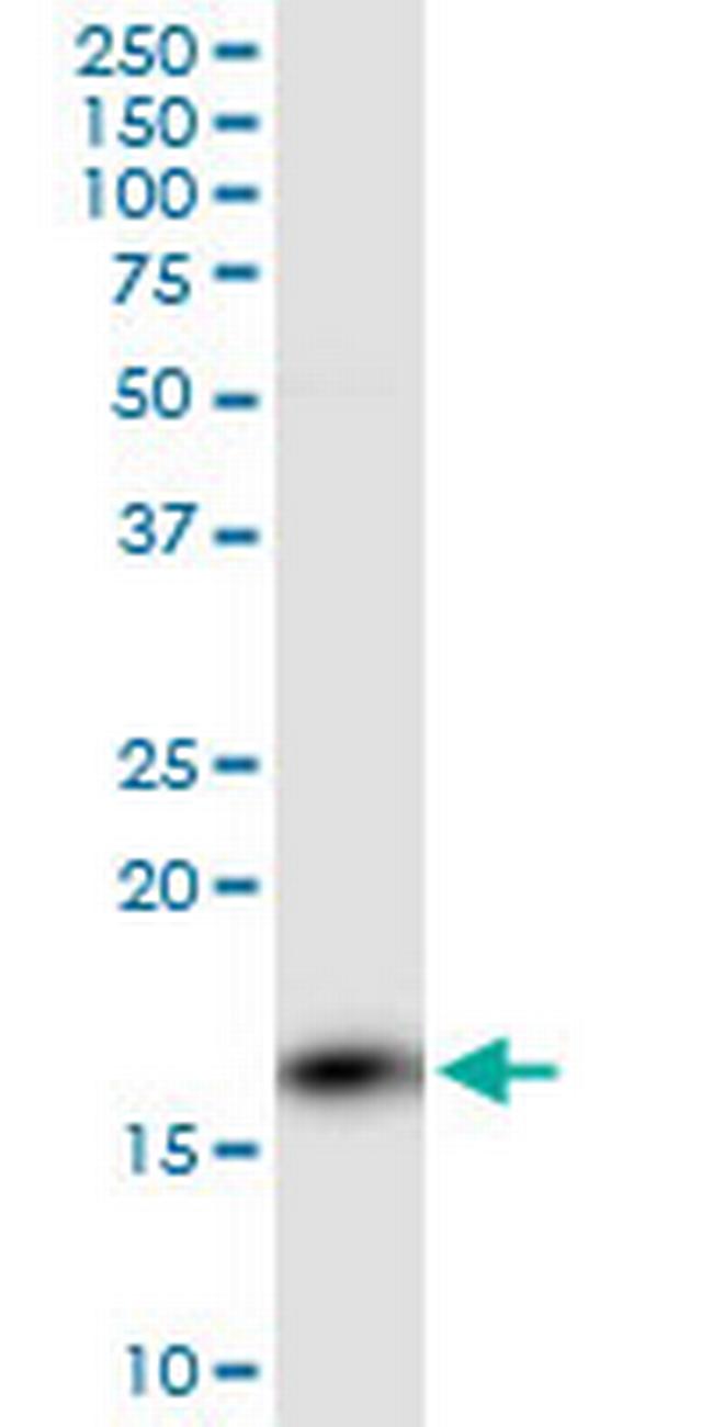 PPP3R1 Antibody in Western Blot (WB)