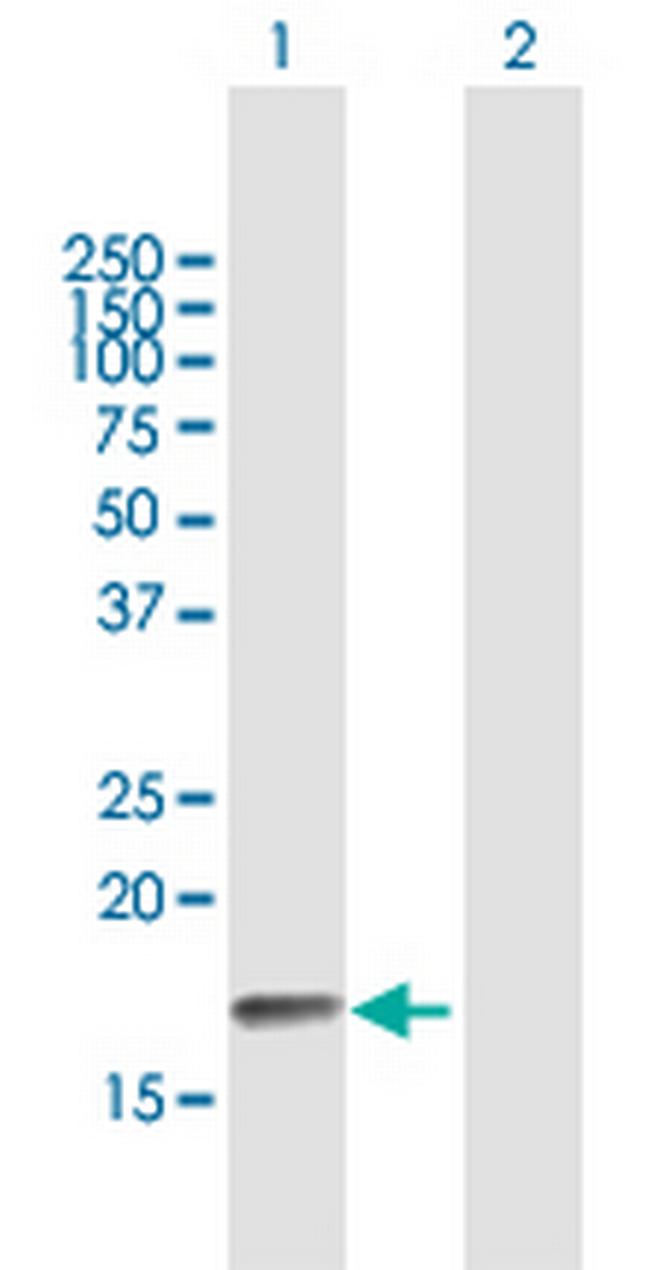 PPP3R2 Antibody in Western Blot (WB)