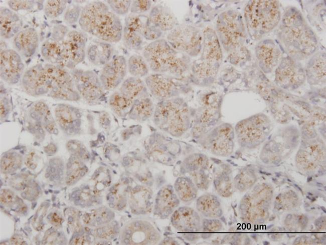 PPT1 Antibody in Immunohistochemistry (Paraffin) (IHC (P))