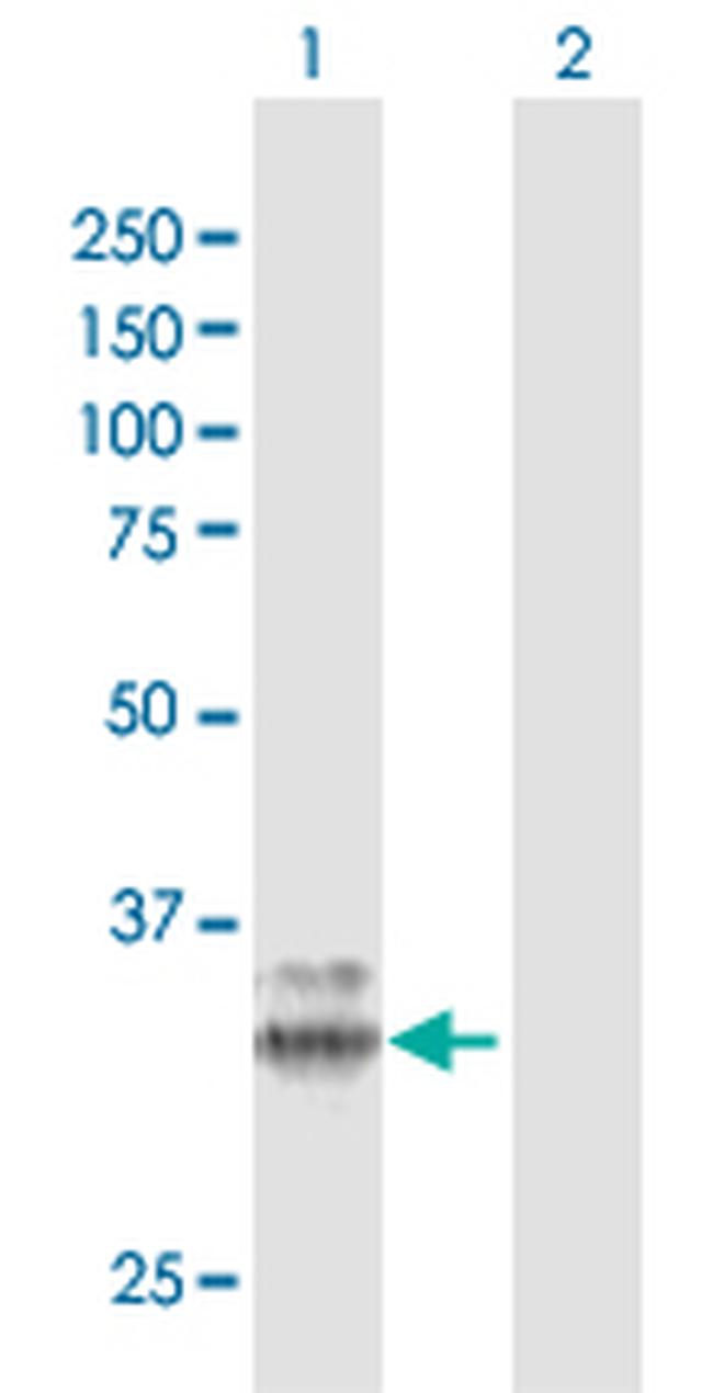 PPT1 Antibody in Western Blot (WB)