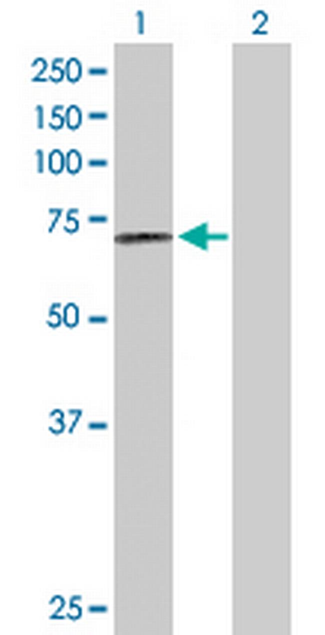 PRCP Antibody in Western Blot (WB)