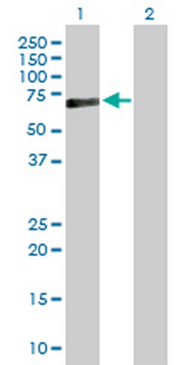 PRF1 Antibody in Western Blot (WB)