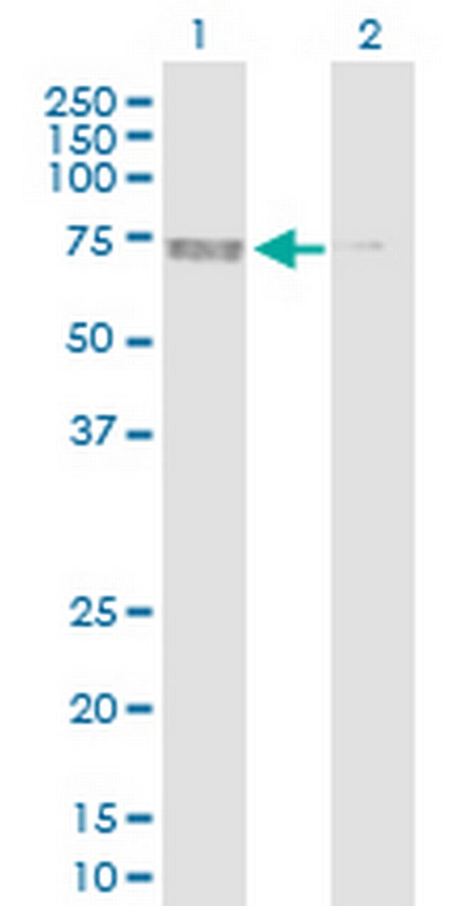 PRKAA2 Antibody in Western Blot (WB)