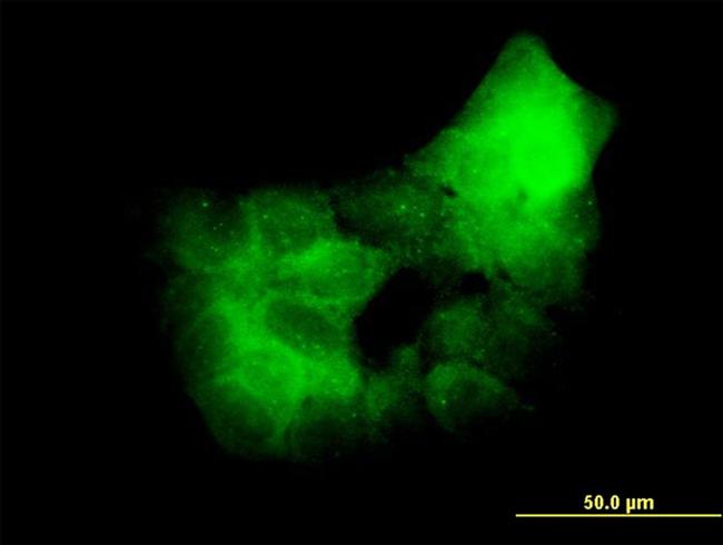 PRKCD Antibody in Immunocytochemistry (ICC/IF)