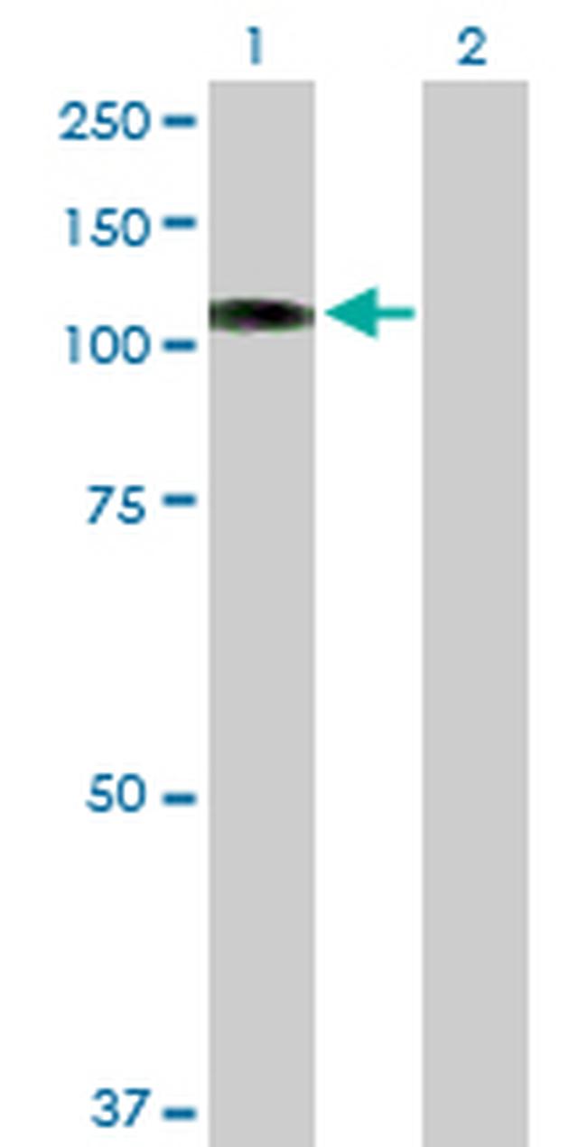 PKN1 Antibody in Western Blot (WB)