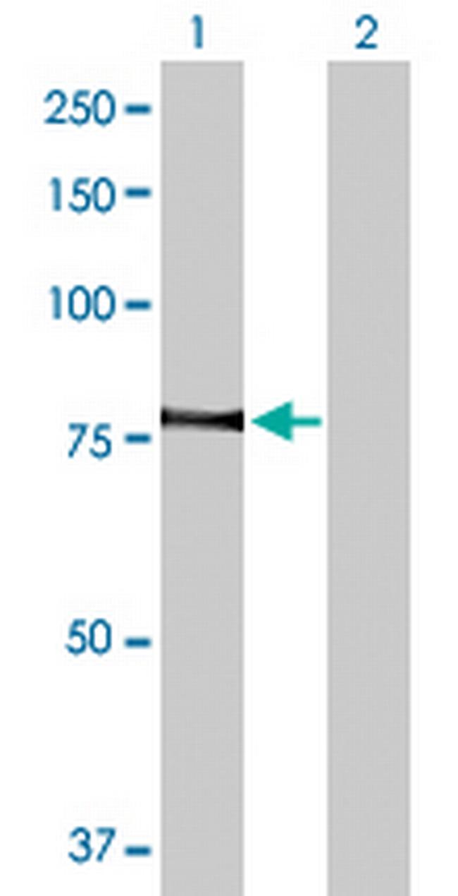 PRKCQ Antibody in Western Blot (WB)