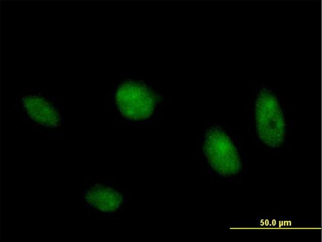 MAPK8 Antibody in Immunocytochemistry (ICC/IF)