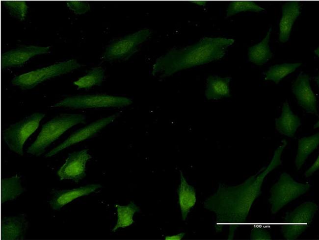 MAPK8 Antibody in Immunocytochemistry (ICC/IF)